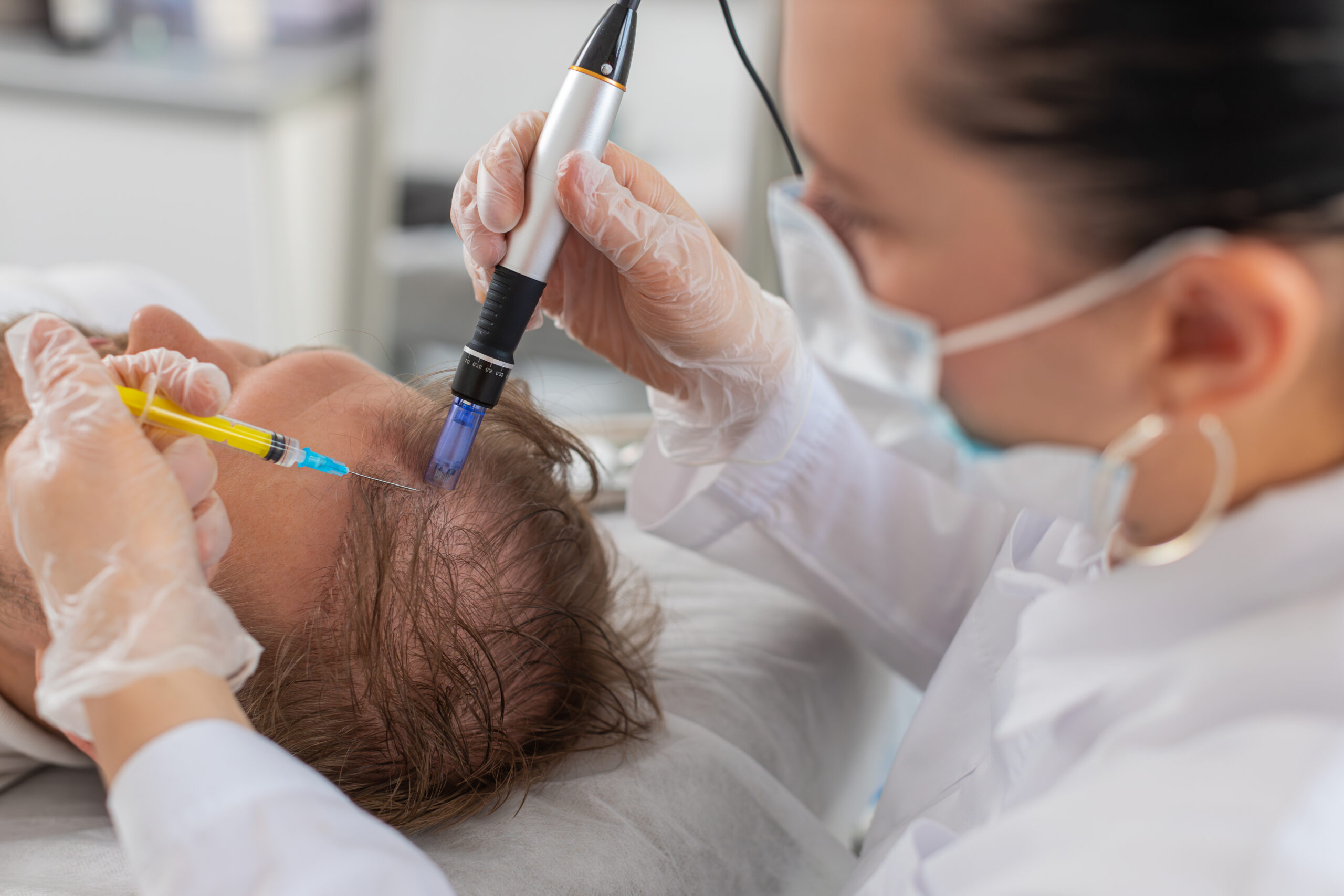 Exosomes Hair Restoration Procedure